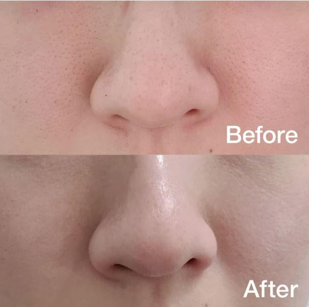 Medicube Zero Pore Oil Control Pad – Almofada Absorvente para Oleosidade e Poros