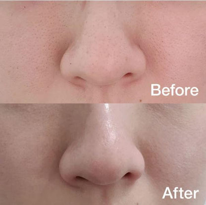 Medicube Zero Pore Oil Control Pad – Almofada Absorvente para Oleosidade e Poros